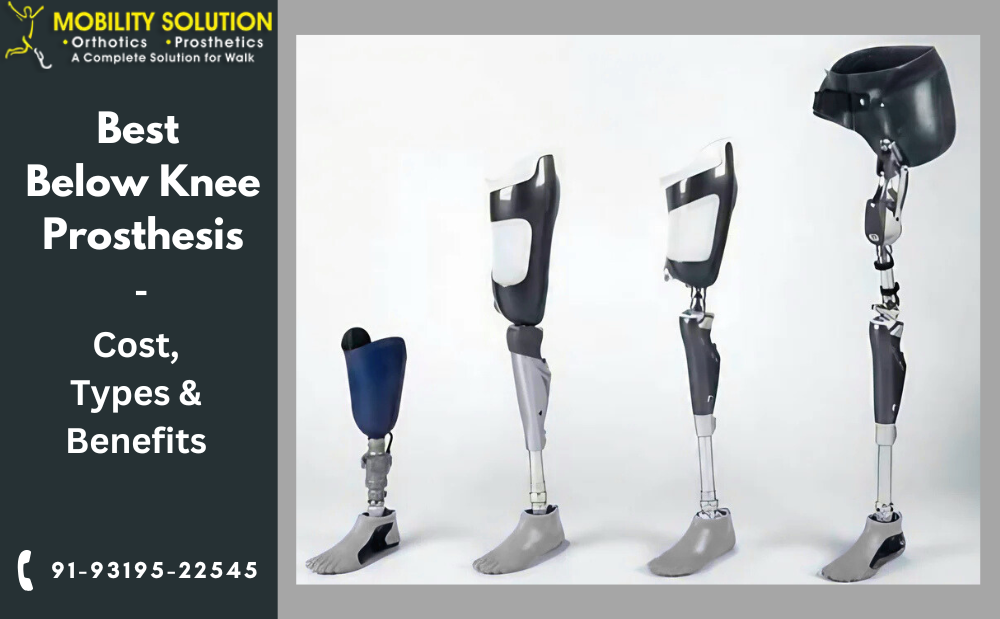 Below-Knee Prosthesis: Restoring Mobility and Confidence After Limb Loss