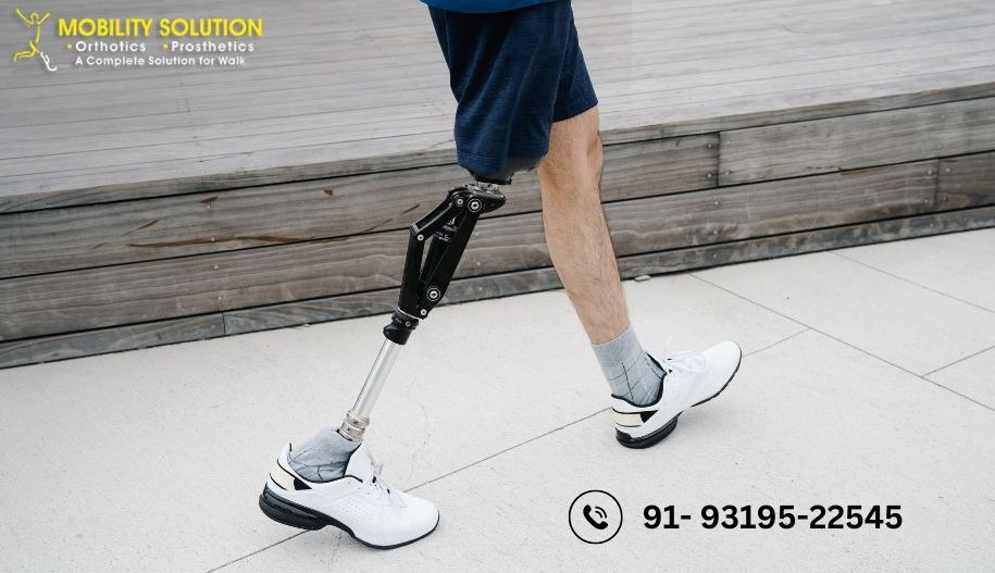 Artificial Leg Cost in India: Price, Types & Full Guide